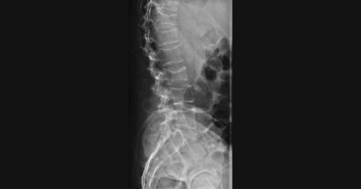 Elderly Man With Back Pain And Thirst